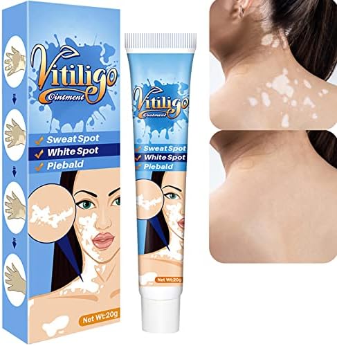 Крем от Витилиго Лечение на Витилиго при Витилиго на кожата, Крем за Намаляване на белите петна и подобряване на Пигментацията на кожата