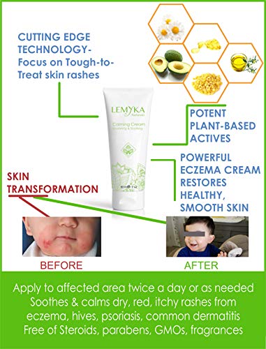 Естествен успокояващ крем LEMYKA Eczema Flare на Отбраната - 3 опаковки, за бебета, деца и възрастни с екзема (атопичен дерматит), Сухи
