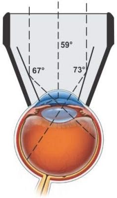 Оптични лещи с едно огледало Goniolens за гледане на ъгъла на Предната камера и на Централната и периферната ретина