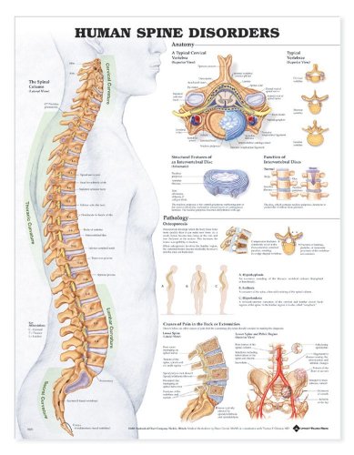 Анатомическая схема на заболявания на гръбначния Стълб на Човека