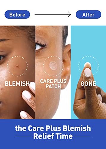 Olive Young Care Plus Хирургична помощ 1 Опаковка | Гидроколлоидный корейски хирургична помощ от акне, за покриване на пъпки и петна, за проблемна кожа и лицето (брой 102 - 10мм * 7