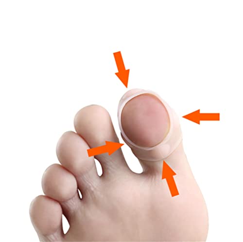 Ръкави-Коректори за врастнали нокти на краката, 4 Двойки от Еластични Силиконови Инструменти За корекция на Врастнали нокти На Краката си,