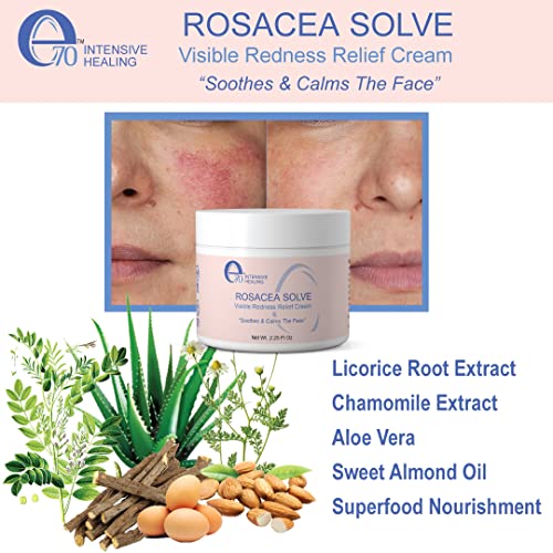 E70 Rosacea Solve - Крем за облекчаване на покраснений - Успокояващ хидратиращ крем за лице При розацея и склонна към акне кожа - Грижа за чувствителна кожа С биологични със?